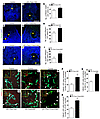 LEC-specific deletion of Foxc1 and Foxc2 leads to increased LEC specificati