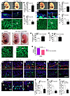 LEC-specific ablation of Foxc1 and Foxc2 results in abnormal lymphatic vess