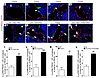 LEC-Foxc-KO mice display increased ERK activation in the lymph sacs.