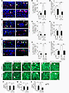 Inhibition of ERK hyperactivation in LEC-Foxc-KO mice rescues enlarged lymp