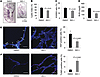 Treatment with ISO-1 delayed cyst growth in Pkd1fl/fl Pkhd1-Cre mice.