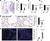 MIF and Pkd1 double KO delayed renal cyst formation.