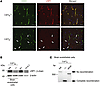 Full deletion of Lrp1 in Lrp1BE–/– mice.