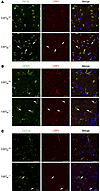 Brain endothelial–specific deletion of Lrp1 in Lrp1BE–/– mice.