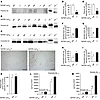 BBB clearance of Aβ species in 5xFAD mice is regulated by brain endothelial