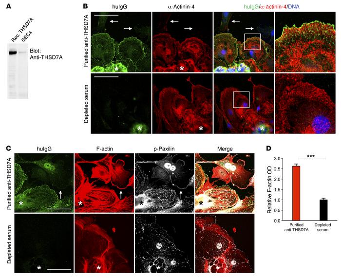 Anti-THSD7A antibodies cause cytoskeletal rearrangement in THSD7A- expre...