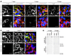 Anti-THSD7A antibodies induce the histological features of MN in mice.