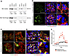 Affinity-purified anti-THSD7A antibodies induce MN in mice.