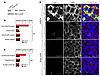 Anti-THSD7A antibodies induce cell detachment and cytoskeletal rearrangemen