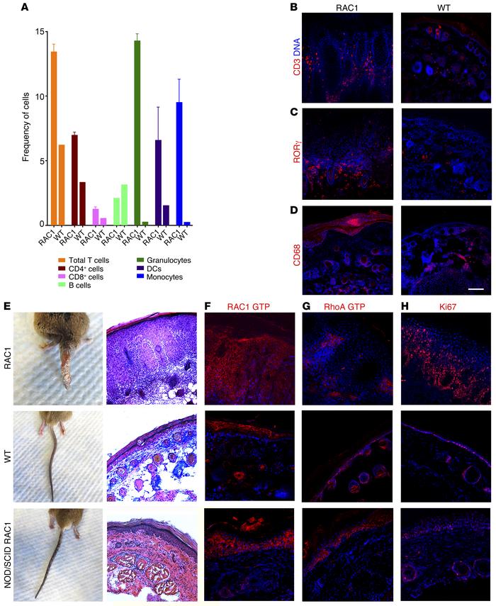 Psoriasiform phenotype in Rac1V12 mice requires an intact immune system....