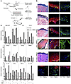 Epidermal RAC1 promotes an immunoproliferative psoriasis phenotype.