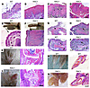 Epidermal RAC1 activation produces a psoriasiform phenotype including skin,