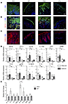 Rac1V12 mice exhibit differential regulation of the epidermal proteins and