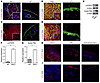 Epidermal RAC1 activation induces NFκB and immune-dependent STAT3 signaling