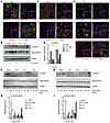 RAC1-dependent signaling in psoriatic keratinocytes of STAT3-, NFκB-, and I