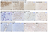 Histological features of MS lesions with phase rim.