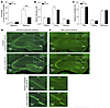 M1 mAChRs play an important role in hippocampal-dependent learning and memo