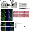 Mouse prion disease is associated with the accumulation of misfolded prion