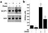 Basal and fatty acid–activated M-CPT I gene expression is repressed during