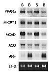 Downregulation of PPAR-α and FAO enzyme gene expression in the pressure ove