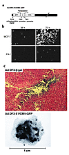 Characterization and intratumoral distribution of Ad.DF3-E1/CMV-GFP. (a) St