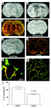 Gd-DTPA contrast-enhanced MRI images of ischemic brains treated with rhVEGF