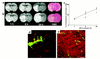 Evolution of the ischemic lesion from 1 hour to 24 hours after MCA occlusio