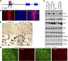 CRISPR/Cas9 depletes the ubiquitous expression of mHTT in homozygous HD140Q