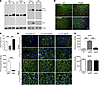 Removal of mHTT in neuronal cells alleviates neuropathology in 13-month-old