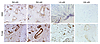 Immunohistochemical staining of synovial tissue for GNS and FLNA.