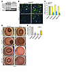 Canonical TGF-β signaling mediates myofibroblast transformation in vitro.