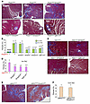 Fibroblast-specific deletion of canonical TGF-β signaling reduces myocardia