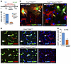 Fibroblast-specific Smad2/3 deletion alters myofibroblast activity in vivo.