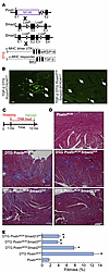 Fibroblast-specific deletion of Smad2/3 reduces TGF-β–induced myocardial fi