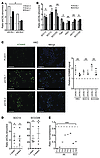 KDM6B expression increases in HKCs and SCC cells with CSL gene silencing an