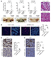 KDM6B as a downstream CSL target mediating its tumor-suppressive function.