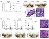 Tumor modulatory effects of increased versus suppressed CSL expression on S