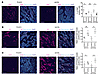 Decreased proliferation and increased differentiation in tumors formed by S