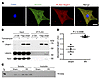 Ubqln1 colocalizes with the proteasome and is recruited to the ERAD pathway