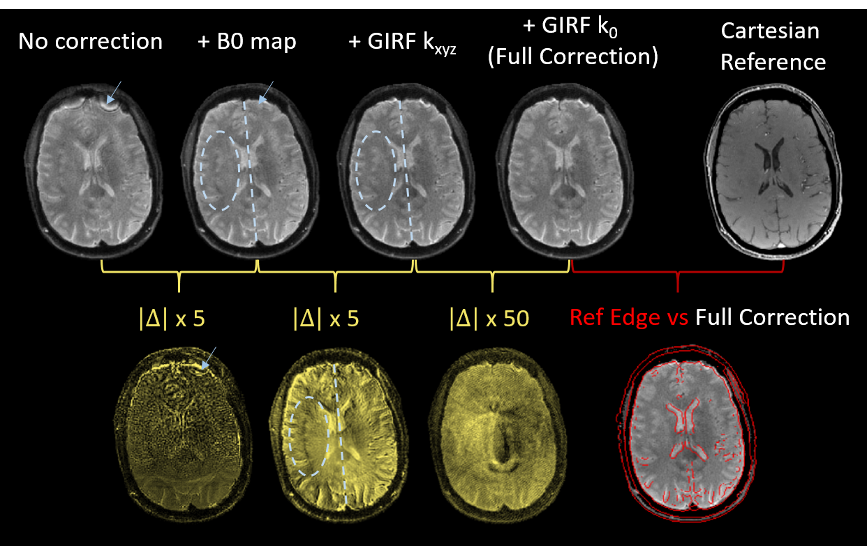 In-vivo Brain Image