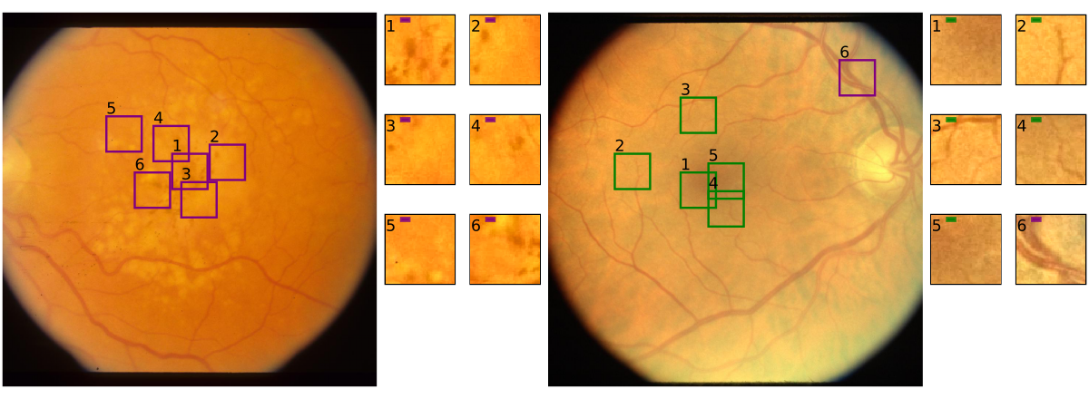 Figure 3: Example of most important image patches