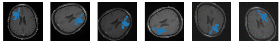 Brain MRI