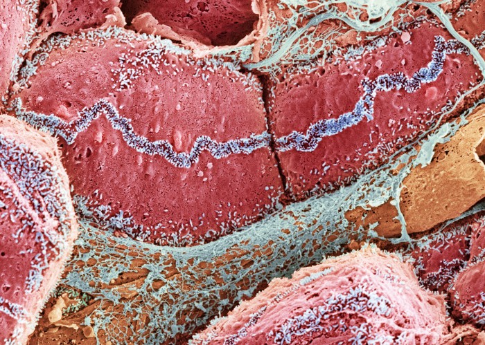 A coloured scanning electron micrograph of liver tissue shown in red, blue and orange colours