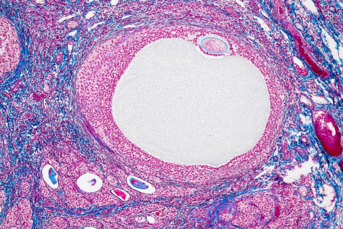 Light micrograph of a section through an ovary shown in blue, pink and purple colours.