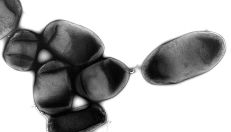 Shigella flexneri (Shigellen), Bakteriengruppe. Transmissions-Elektronenmikroskopie, Negativkontrastierung. Maßstab = 1 μm. Quelle: © Hans R. Gelderblom, Gabi Schlier, Rolf Reissbrodt/RKI