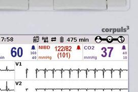 Display of the remaining battery life in minutes