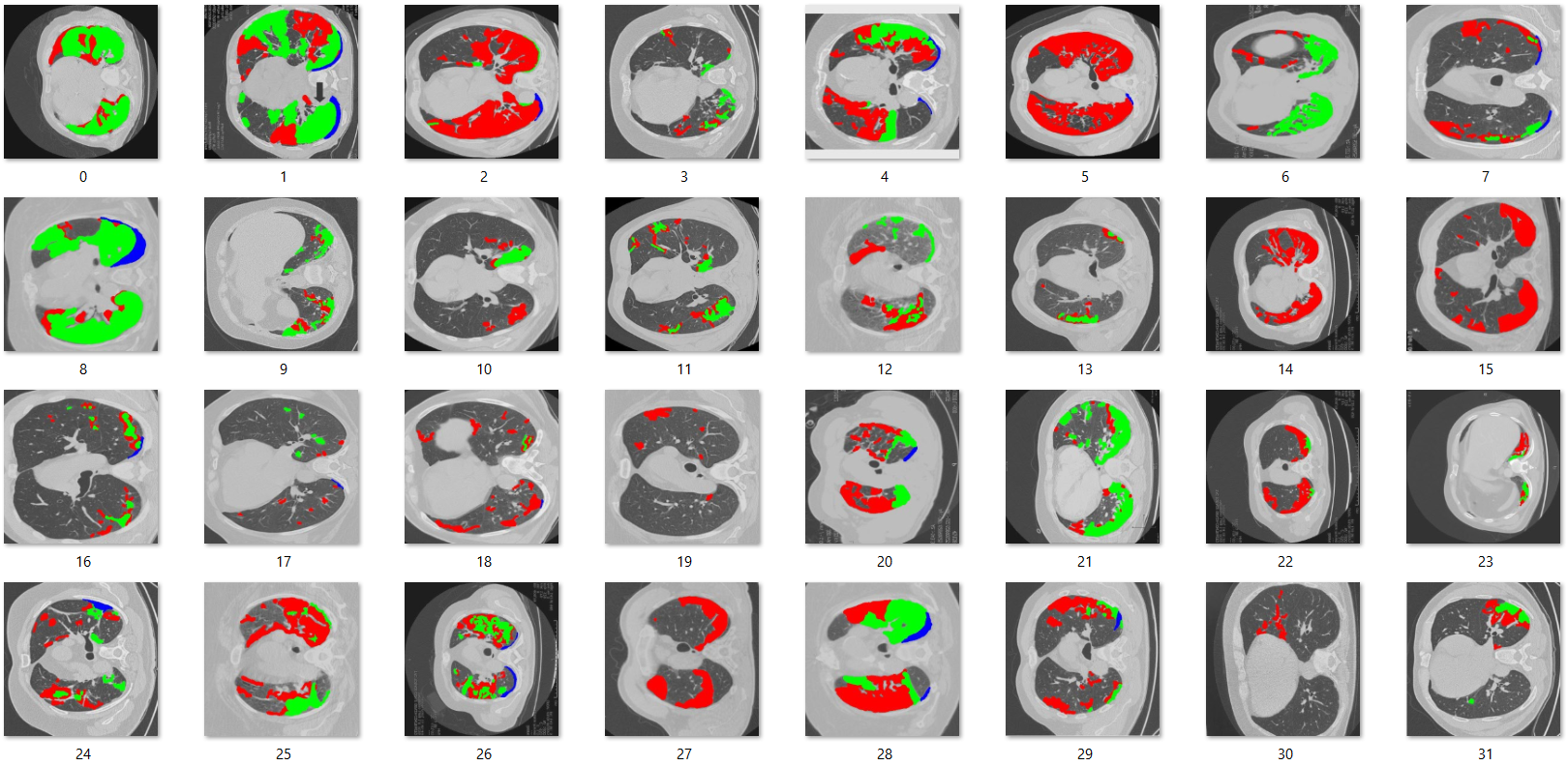 Ground-truth masks for axial chest CT scans