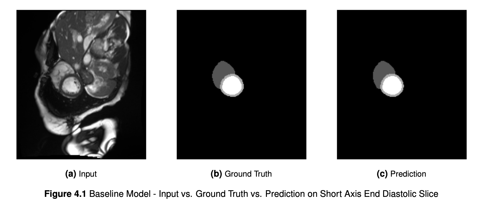 Segmentation