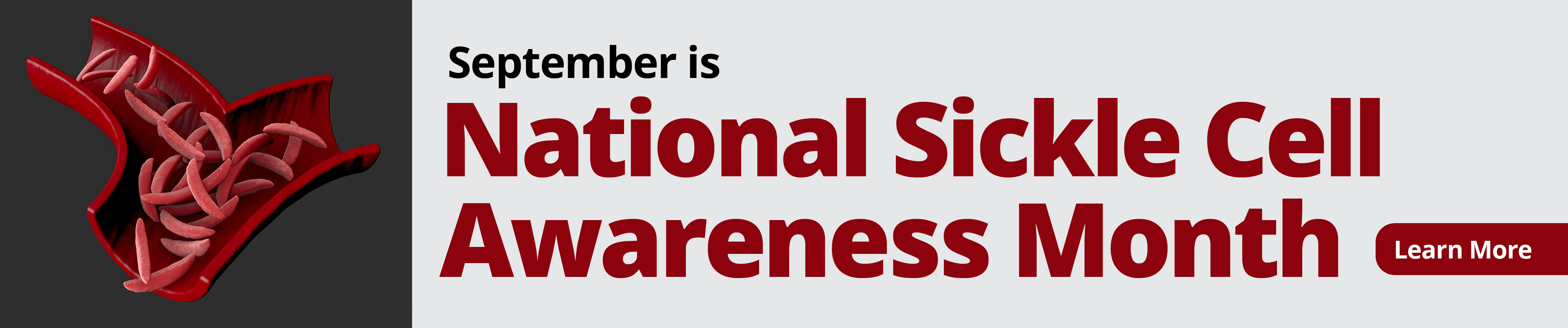 September is National Sickle Cell Awareness Month