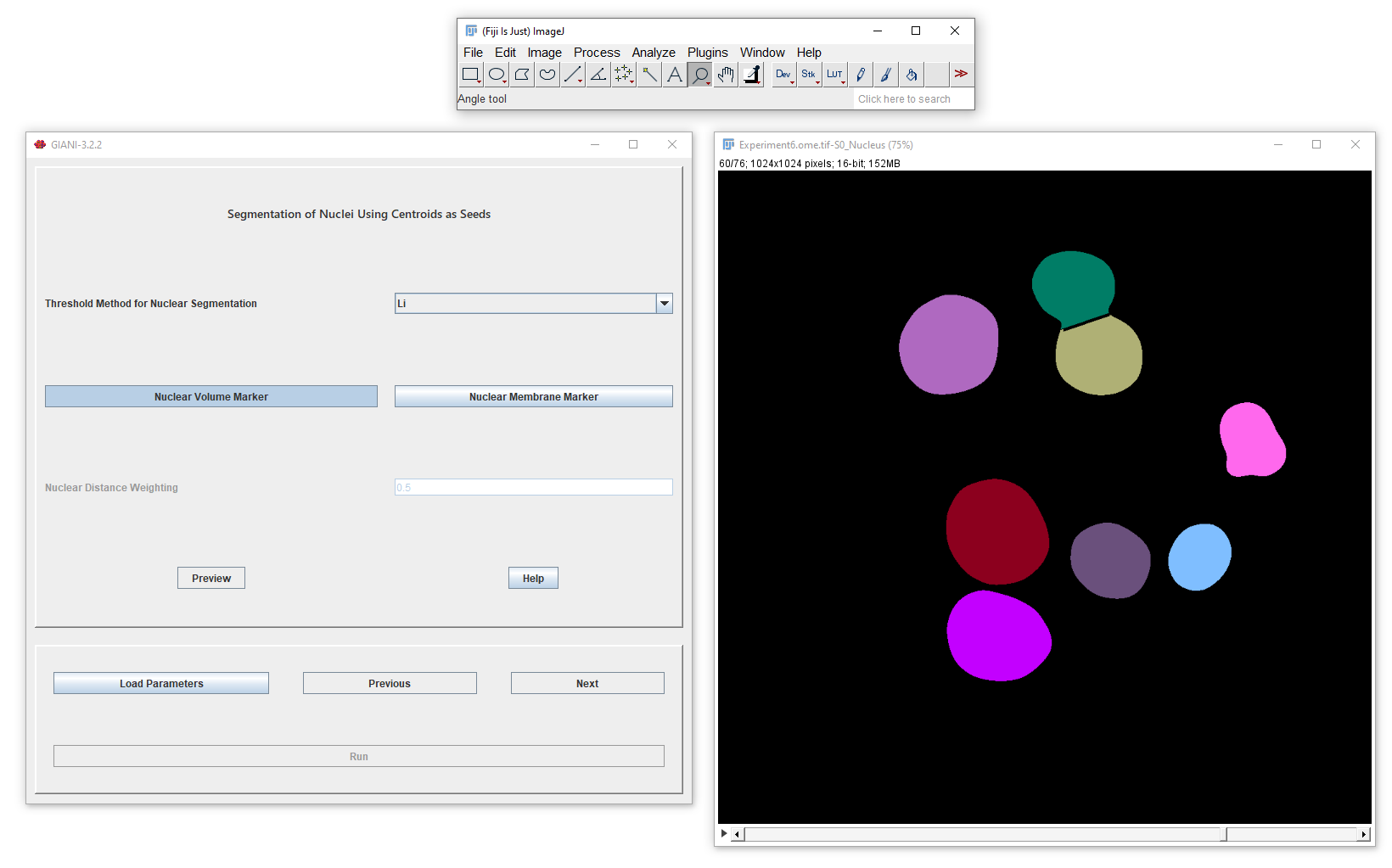 Nuclear Segmentation Preview